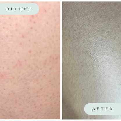 Wildpier™️ Luxe Deep Exfoliating Glove